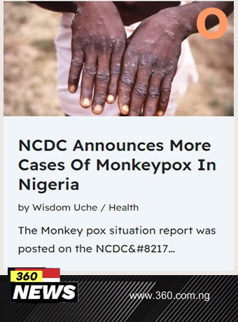 NCDC Announces More Cases Of Monkeypox In Nigeria